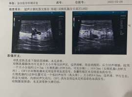 左上胸部有时疼痛